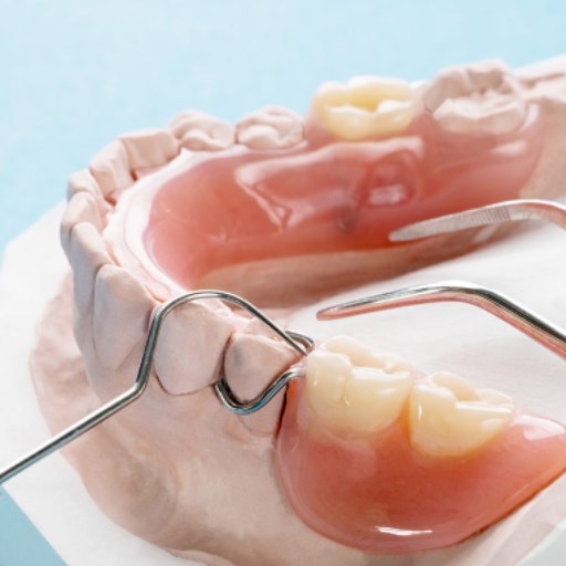 Removable Denture, Cast Partial Denture & Flexible Partial Denture